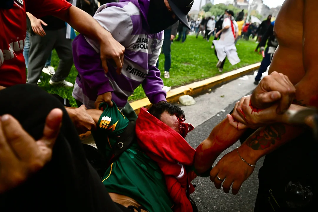 A dos años del protocolo Antipiquetes, denuncian más de 2.500 heridos